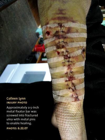 arm-injury-website-photo